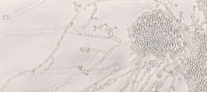 Candida albicans