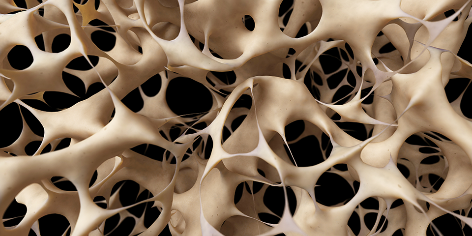 Image from National Osteoporosis Foundation